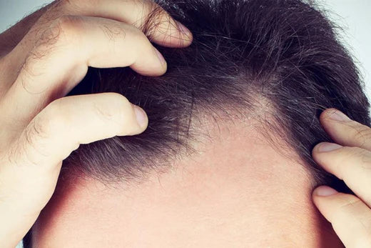 what are the signs of weak hair