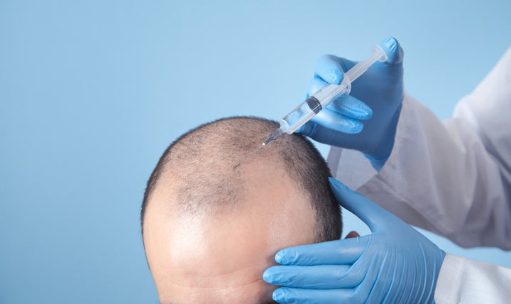 Hair transplant