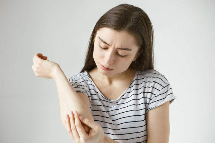 a woman scratching her elbows