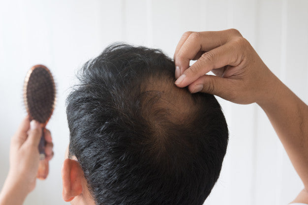 Causes of hair loss