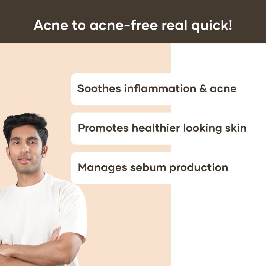 Anti Acne Gel with Salicylic Acid (30 gm)