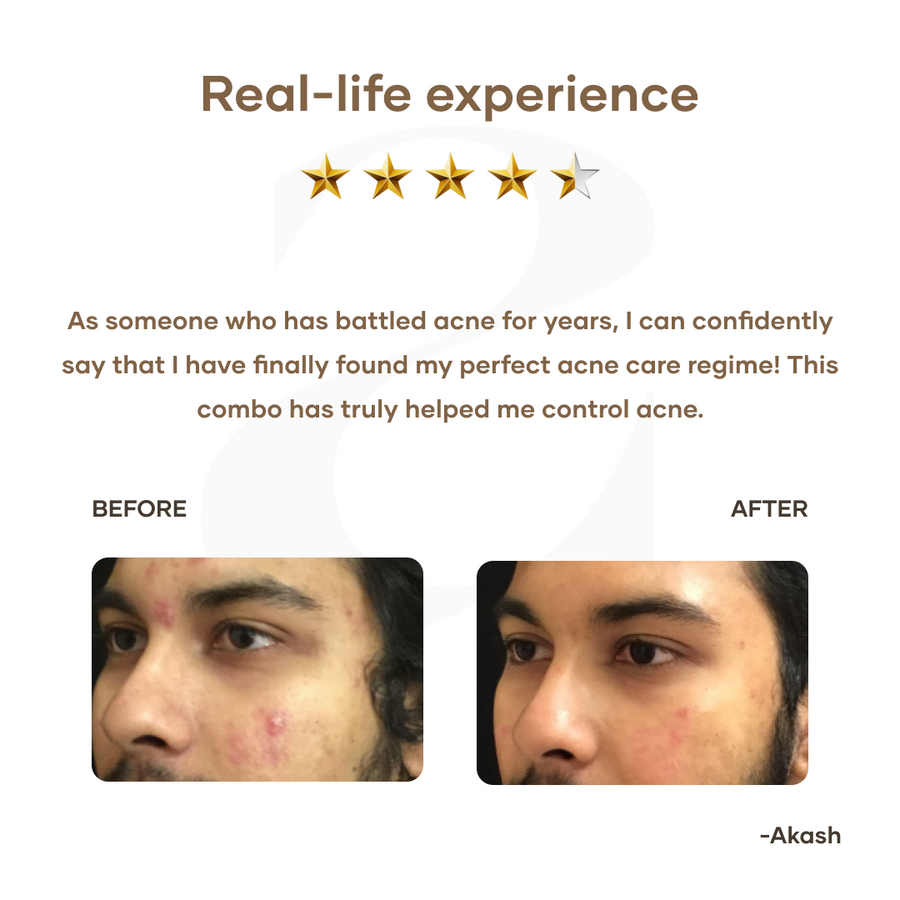 Mars Ultimate Acne Care Regime